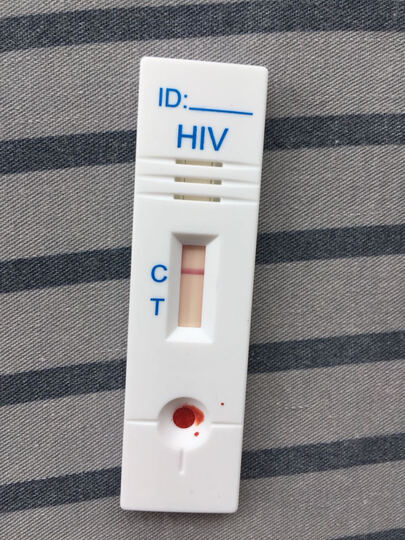 准信hiv检测试纸:"分别是5.10.15.20.25.