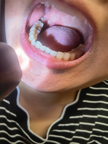 老司机介绍素士w1和贝医生冲牙器？质量真的差吗