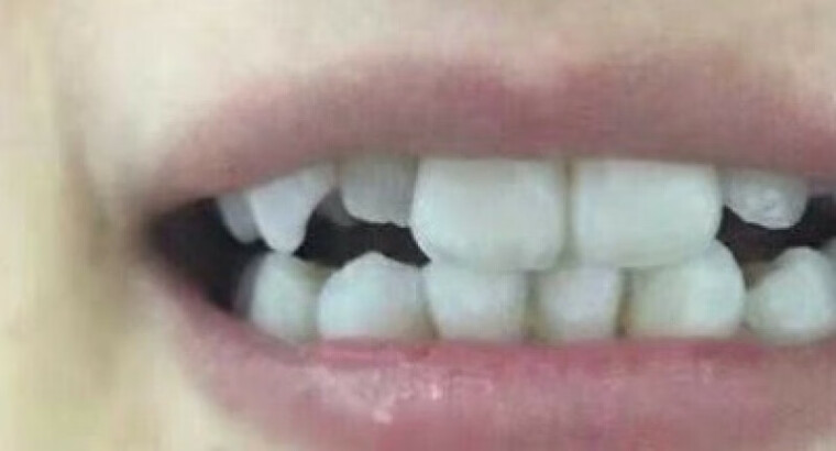 「网友评价」医后牙膏牙膏怎么样的质量，评测为什么这样？