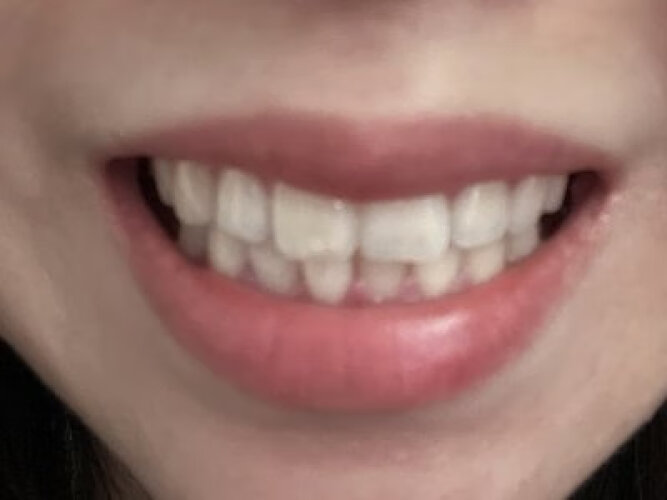 网友剖析牙粉迪王酵素珍珠白牙素功能评测结果，看看买家怎么样评价的