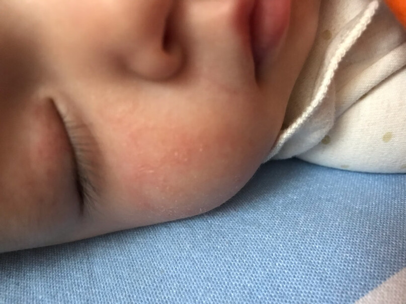 戴·可·思Dexter宝宝面霜脸上要是有湿疹能用吗？