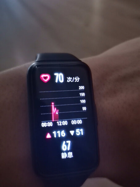 HUAWEI华为手环7标准版小米手机怎么下载心脏健康研究？