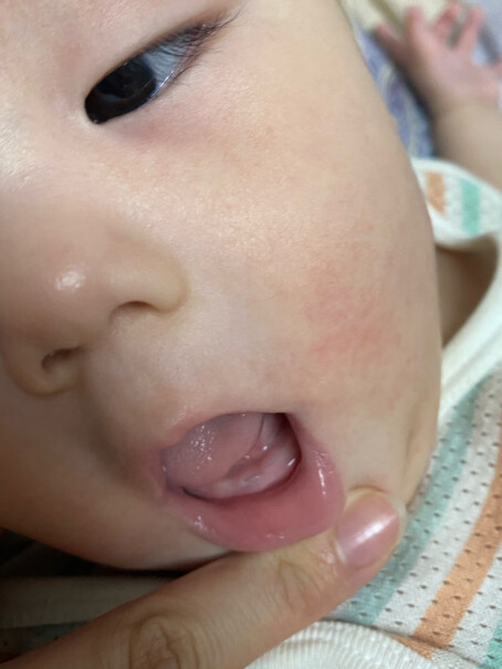 Akasugu爱舒屋婴儿唇周膏 15g推荐哪种好用？全面了解产品功能特点！