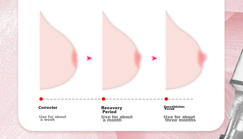Shibeirou Nipple Corrector, Breast Pump, Short And Inward Auxiliary Breastfeeding Aid, Breastfeeding Tool, Discreet Shipping 5