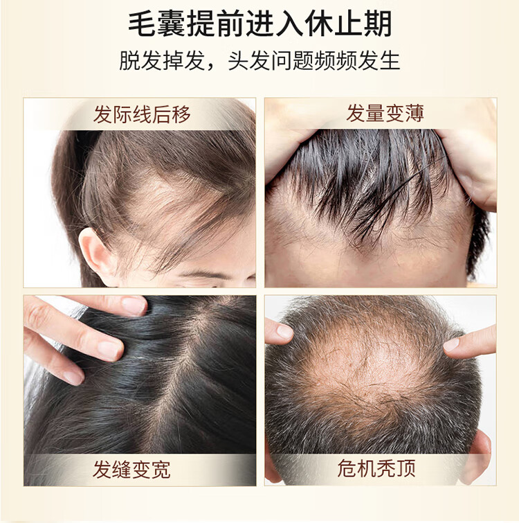 药都仁和药业防脱育发液防脱发护发固发男女士发际线防秃顶头皮护理