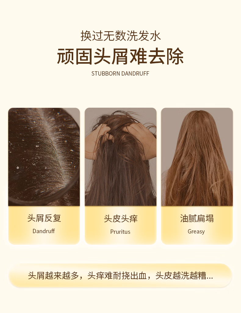 安享好物 安享B级洗发水-SelsunBlue 去屑洗发水  