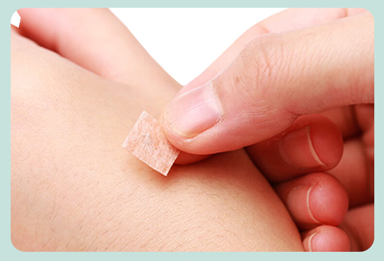 中研太和zhongyantaihe 一次性无菌揿针02215mm 耳针嵌针 揿钉式皮内