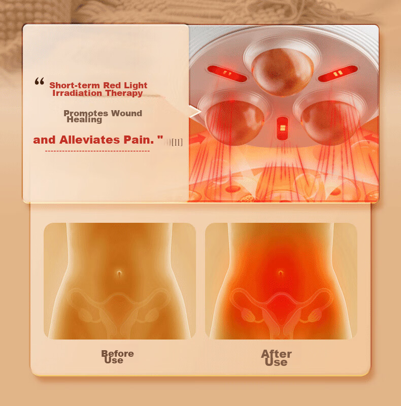 Keaiyuansu Small Suspended Pot, Stone Abdominal Massager, Automatic Stomach And Intestine Massager, Automatic Belly Kneading Device, Peristaltic Weight Loss Aid, Bowel Movement Promoter 26