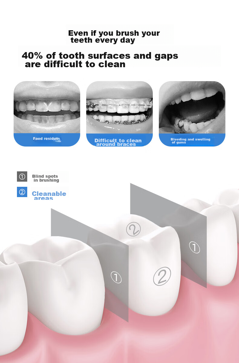 BILESHI Portable Dental Irrigator Water Flosser for Teeth Cleaning And Tartar Removal, Suitable for Teenagers 12 Years And Above, Orthodontic Use, Gift for Boyfriend Or Girlfriend, Model 5260 Yellow 3