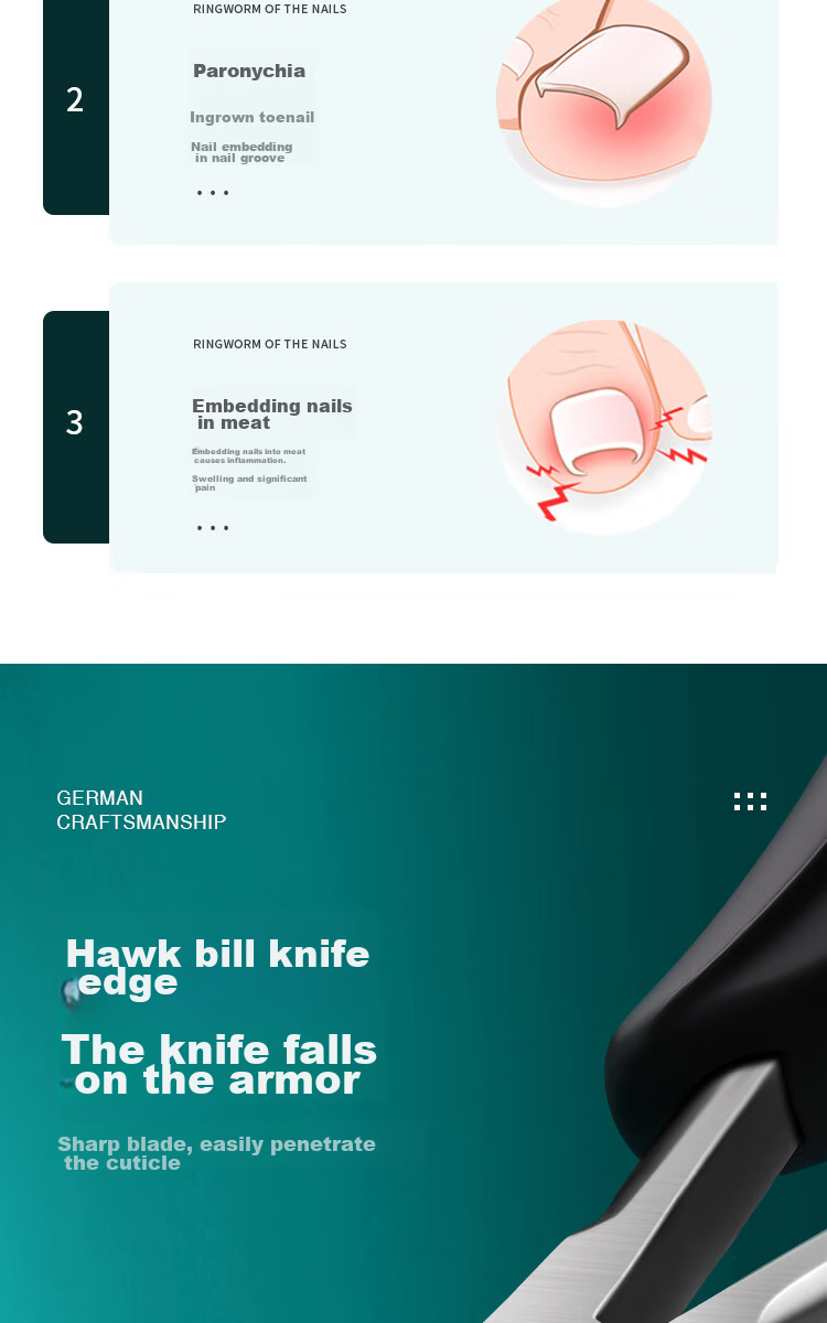 Creative Art Ingrown Toenail Specialized Nail Clipper, Eagle Beak Pliers, Nail Clippers, Ingrown Toenail Clipper, Pedicure Knife, Nail Pliers 3