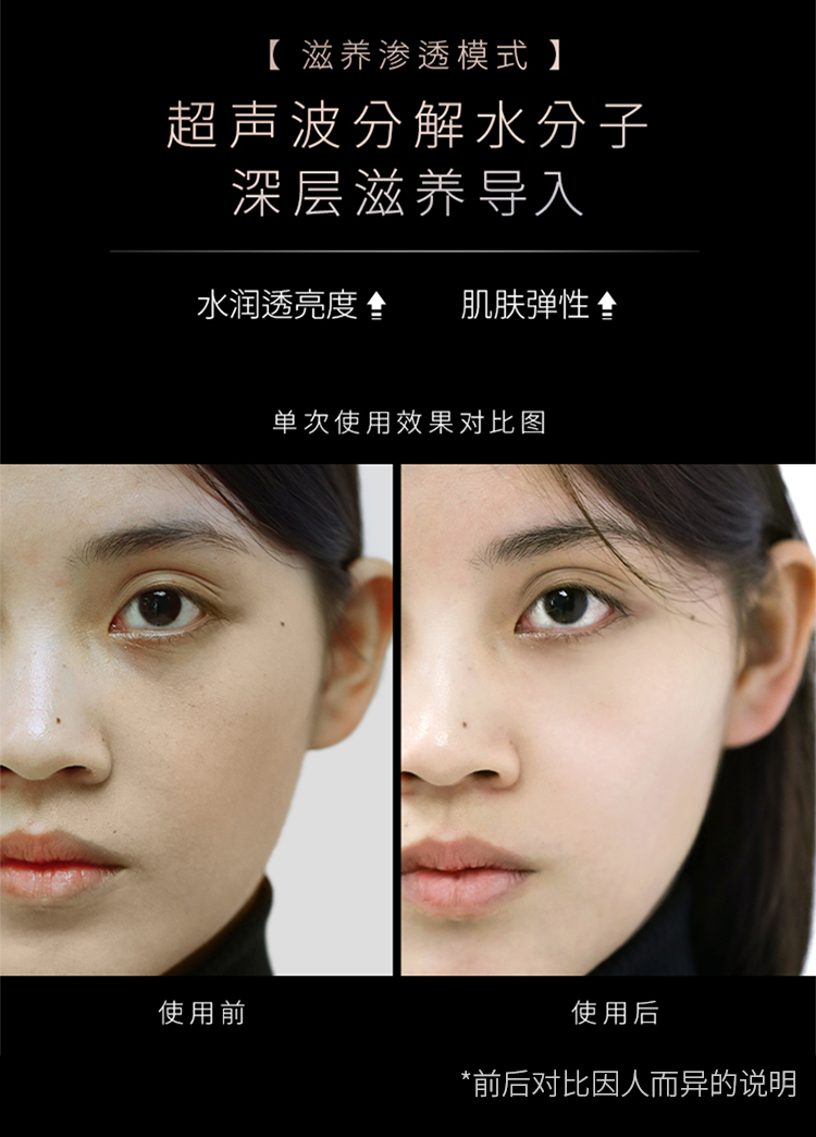 notime 射频美容仪器面部脸部按摩仪导入仪提拉紧致家用小蛮腰小彩虹