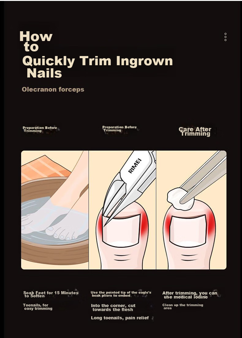 Jiashigao Pedicure Tools Set: Foot Scraper, Callus Remover, Heel Scraper, Foot File for Removing Dead Skin And Calluses 15