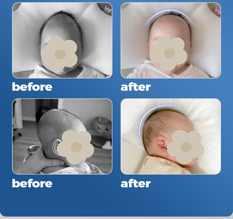 EVOCELER Shaping Pillow for Newborns 0-6 Months, Baby Head Correction Pillow 14