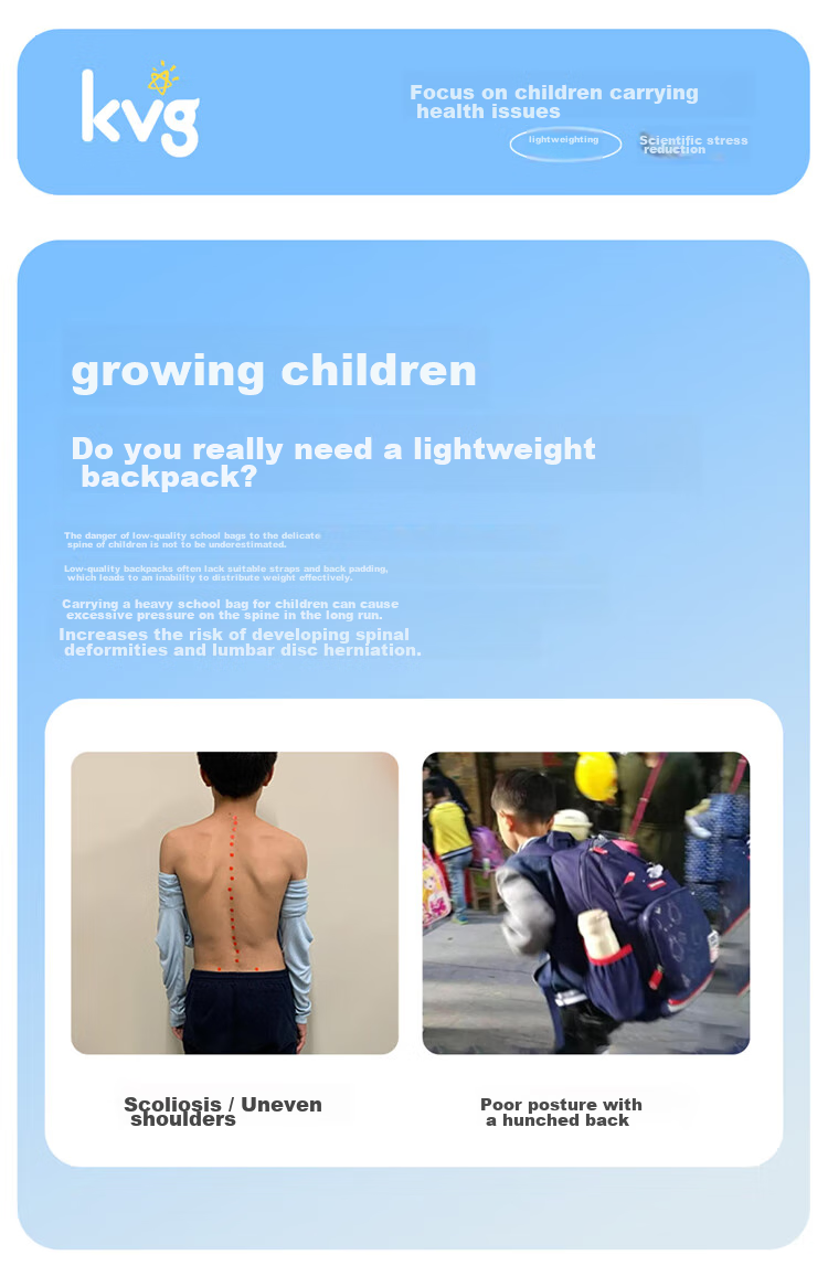 KVG Schoolbag for Primary School Students, Children's Backpack with Spine Protection And Load Reduction, Suitable for Grades 1-3, Double Shoulder Bag for Boys And Girls 2