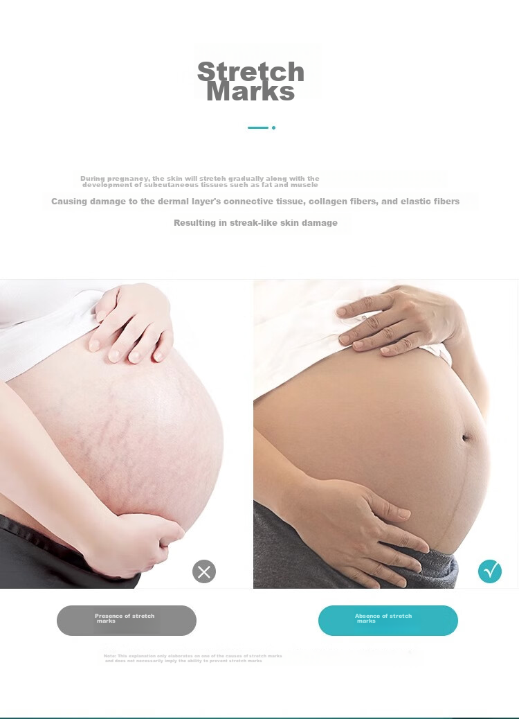 Da Ren You Xi Maternity Support Belt for Late Pregnancy, Belly Band for Pregnant Women, Tummy Control Belt for Late Pregnancy, Practical Gift for Pregnant Wome 6