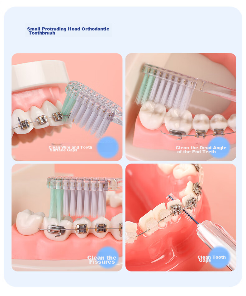 YANDY Orthodontic Toothbrush U-Shaped 3-Pack, Interdental Brush, for Teenagers with Braces, Soft Bristles, Small Head, Portable 7