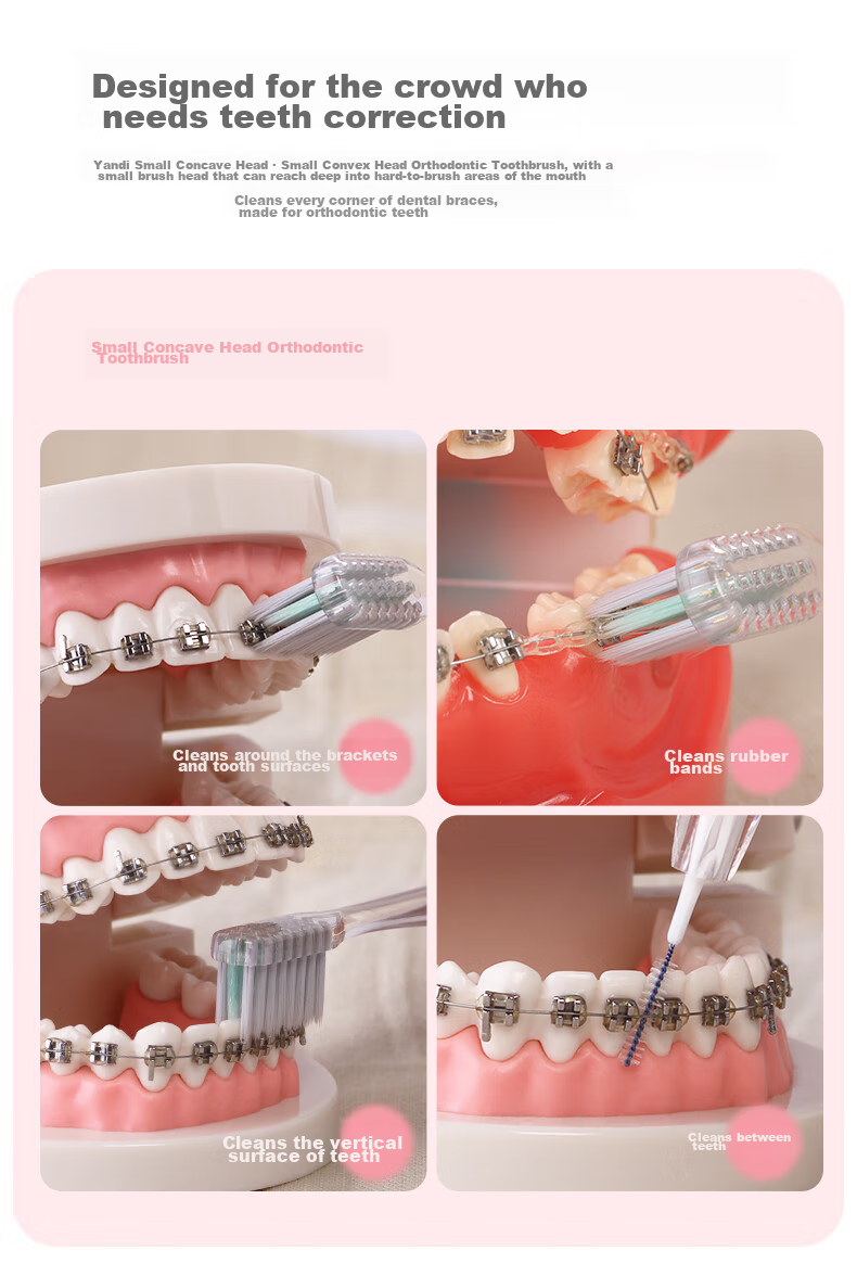 YANDY Orthodontic Toothbrush U-Shaped 3-Pack, Interdental Brush, for Teenagers with Braces, Soft Bristles, Small Head, Portable 6