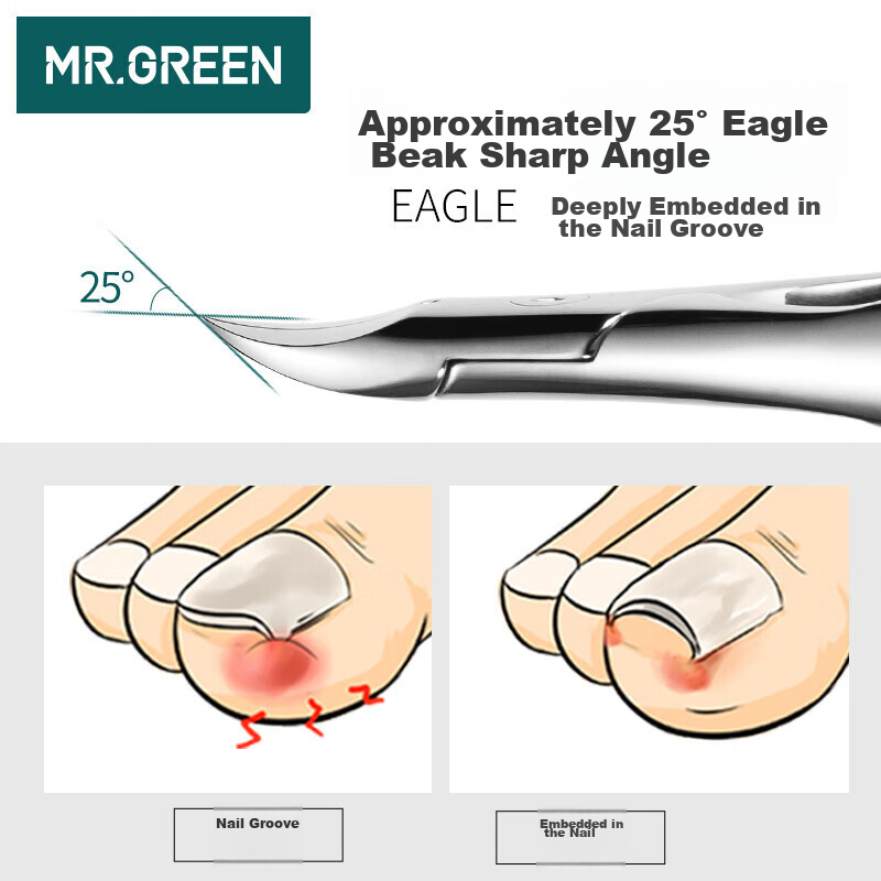 Кусачки для вросших ногтей MR.GREEN Mr-1036, немецкие, для педикюра, из нержавеющей стали