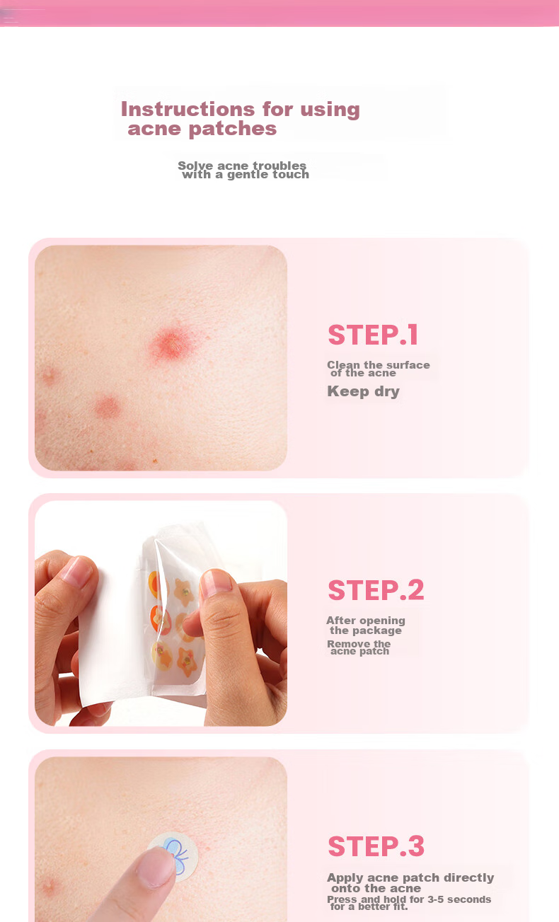 Yaozhi Acne Patch for Women, Concealing, Lightweight, Waterproof, Breathable, Gentle, Soothing, Acne-Fighting, Day And Night Use, Guima Jingling, 36 Patches 12