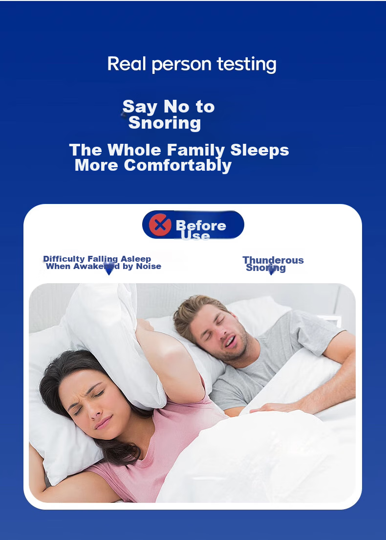 Chidong Mouth Breathing Correction Strap, Open-Mouth Sleeping Aid for Children And Adults, Snoring Prevention, Jaw Retraction Correction, Anti-Snoring Mouth Tape 4