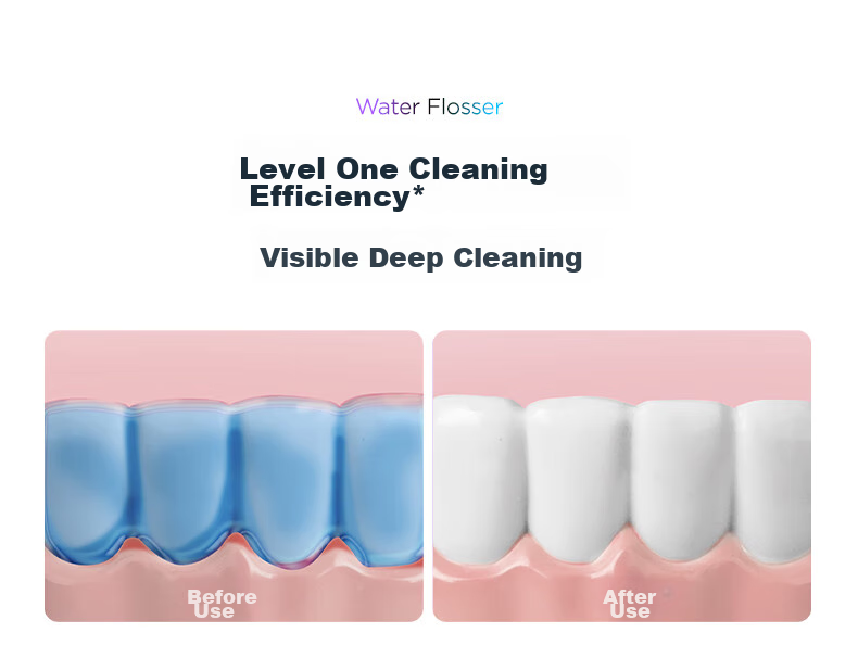 Midea Water Flosser, Portable Oral Irrigator for Adults, Home Use, Milk Tea Cup, Lavender Purple CL2, Recommended As Birthday And Holiday Gift for Couples 10