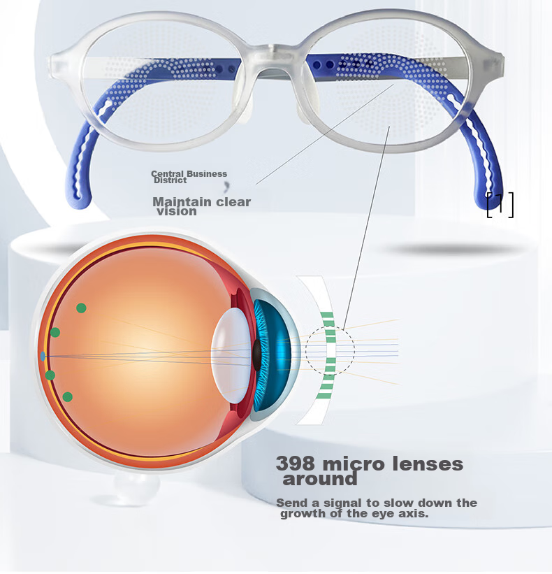 Muyu MU-6802 Children's Dream Series, 45 Lenses, -6.00 to -1.38, Optical Functional Myopia Control And Prevention, Defocus Glasses, Back to School 8