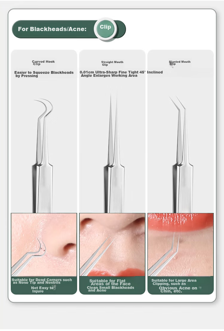 LINGCHEN Acne Needle Tweezers Set of 3, Blackhead Extractor, Pimple Remover Tool, Acne Squeezing Kit 2