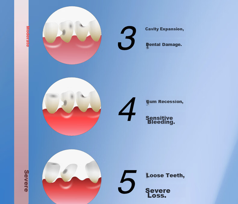 EBISU Four-Stage Bristle Adult Toothbrush, Medium Bristles for Luxurious Oral Care, Deep Cleaning And Fresh Breath, 4 Pieces with Random Colors 6