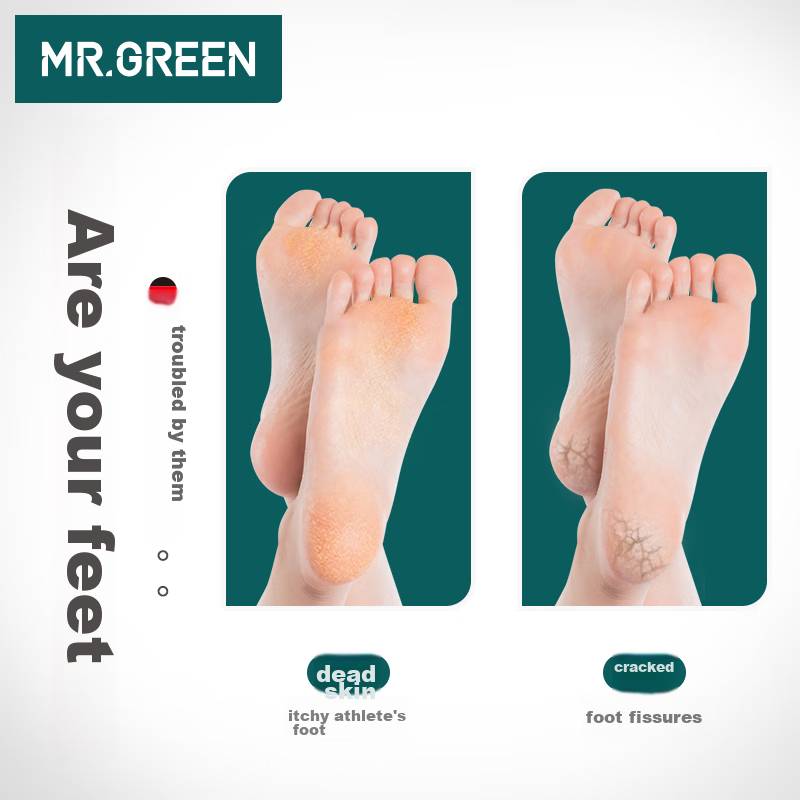 MR.GREEN Немецкая двусторонняя терка для ног, пемза для удаления огрубевшей кожи и мозолей, скребок для пяток, импортный инструмент Mr-2205OR