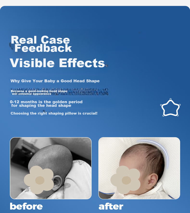 EVOCELER Shaping Pillow for Newborns 0-6 Months, Baby Head Correction Pillow 13