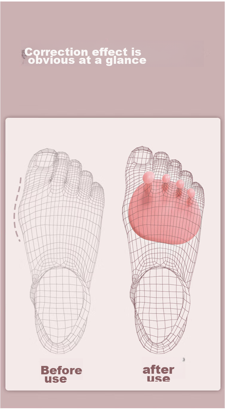 Duweike Arch Trainer Flatfoot Control Board Toe Grip Exercise Rehabilitation Foot Sole Stretching Exercise Pink 9