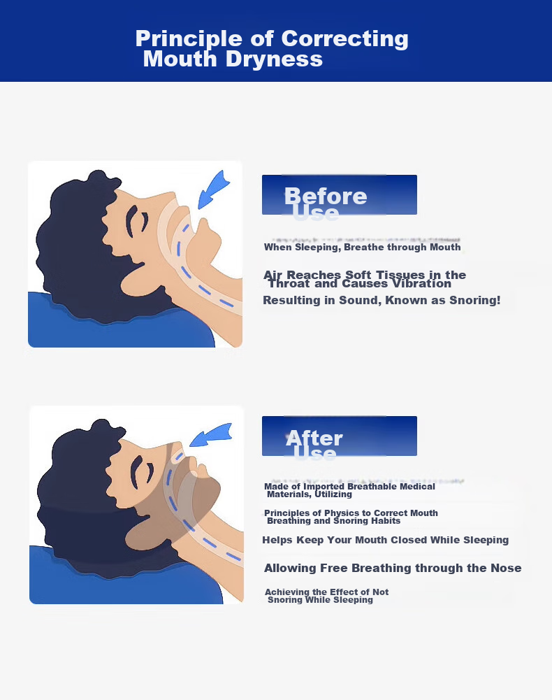 Chidong Mouth Breathing Correction Strap, Open-Mouth Sleeping Aid for Children And Adults, Snoring Prevention, Jaw Retraction Correction, Anti-Snoring Mouth Tape 6