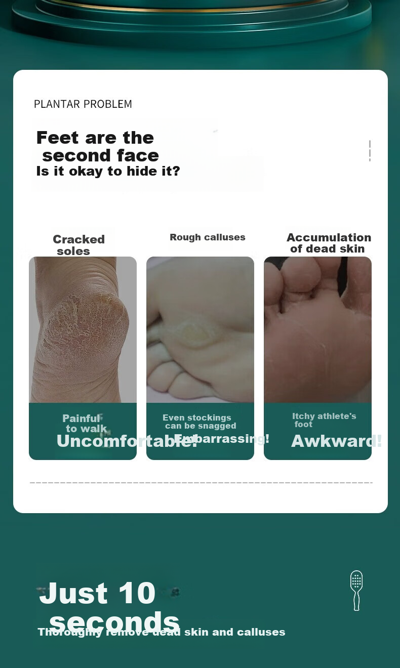 Haifeinuo Foot Scrubber, Pumice Stone, Callus Remover, Dead Skin Remover, Heel Scraper, Foot Exfoliator 2