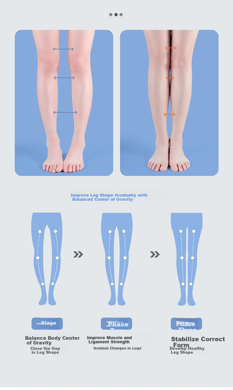FOOTOPPO O-Shaped Leg Insoles for Overpronation, Flat Feet, And Varus Legs with Arch Support for Adults 6