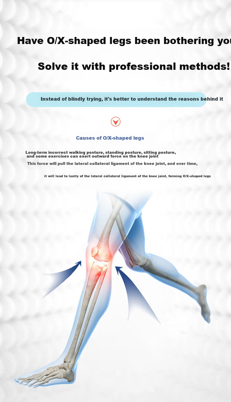 FOOTOPPO Magnetic X-Shaped Leg Insoles for Overlapping Legs, O-Shaped Legs, And X-Shaped Legs for Adults 2
