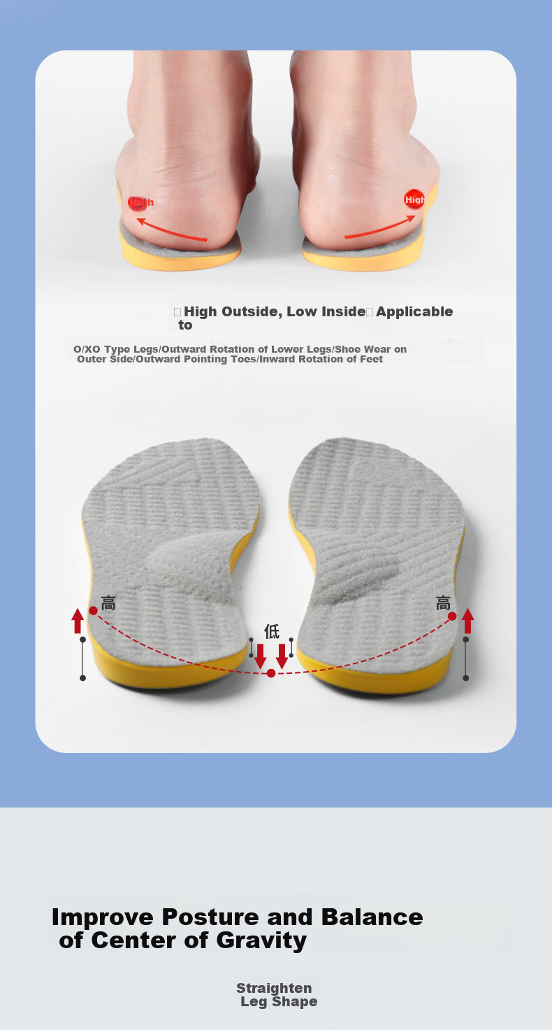 FOOTOPPO O-Shaped Leg Insoles for Overpronation, Flat Feet, And Varus Legs with Arch Support for Adults 5