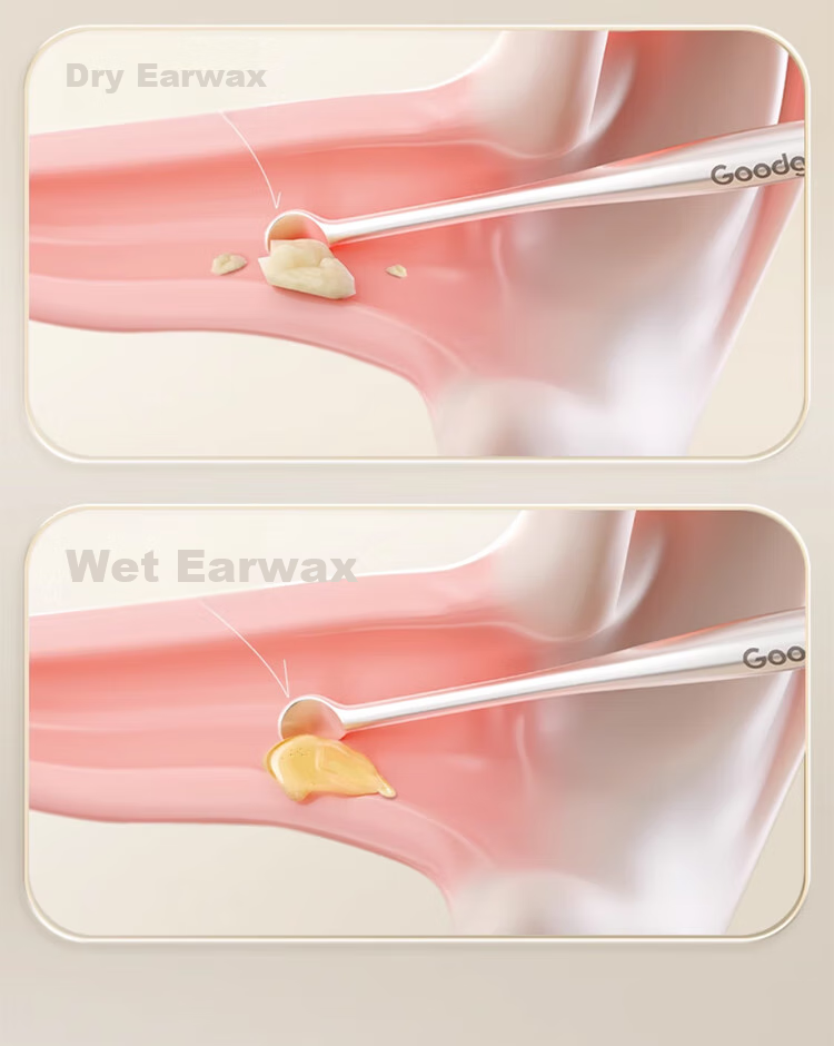 Goood 2-Piece Set, Gentle Double-Ended Ear Pick, High-Quality Smooth Ear Cleaning Tool, Earwax Removal Device 12