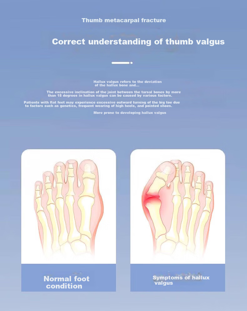BAIHOU White Monkey Corrective Big Toe Sandals, Bunion Correction Functional Split-Toe Slippers, G-01 Pink, Size 35-36 2
