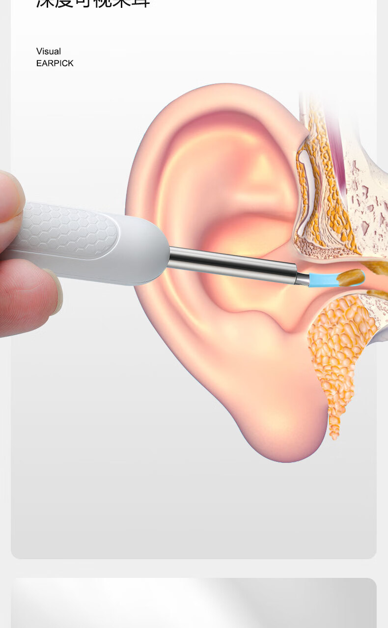 XIAO TIAN LAI Smart Visual Ear Pick HD Wireless Ear Cleaning Tool Visual Ear Scoop 10
