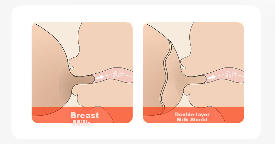 SunnyKinder Breast Shield Newborn Nipple Protector, Breast Patch, Feeding Aid, Breast Pump Auxiliary Nipple, Double-Layer Corrector 5