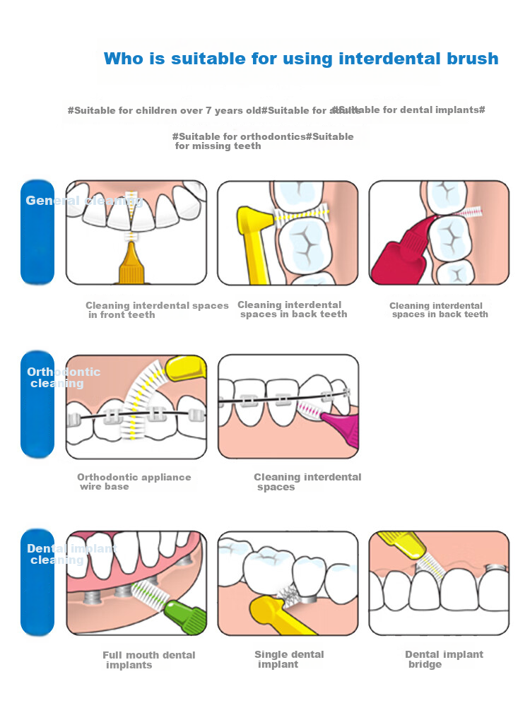 Tepe Swedish Imported Interdental Brush, Orthodontic Appliance Floss Pick, Type I Interdental Cleaner, Dental Floss Stick, Toothpick Brush 5
