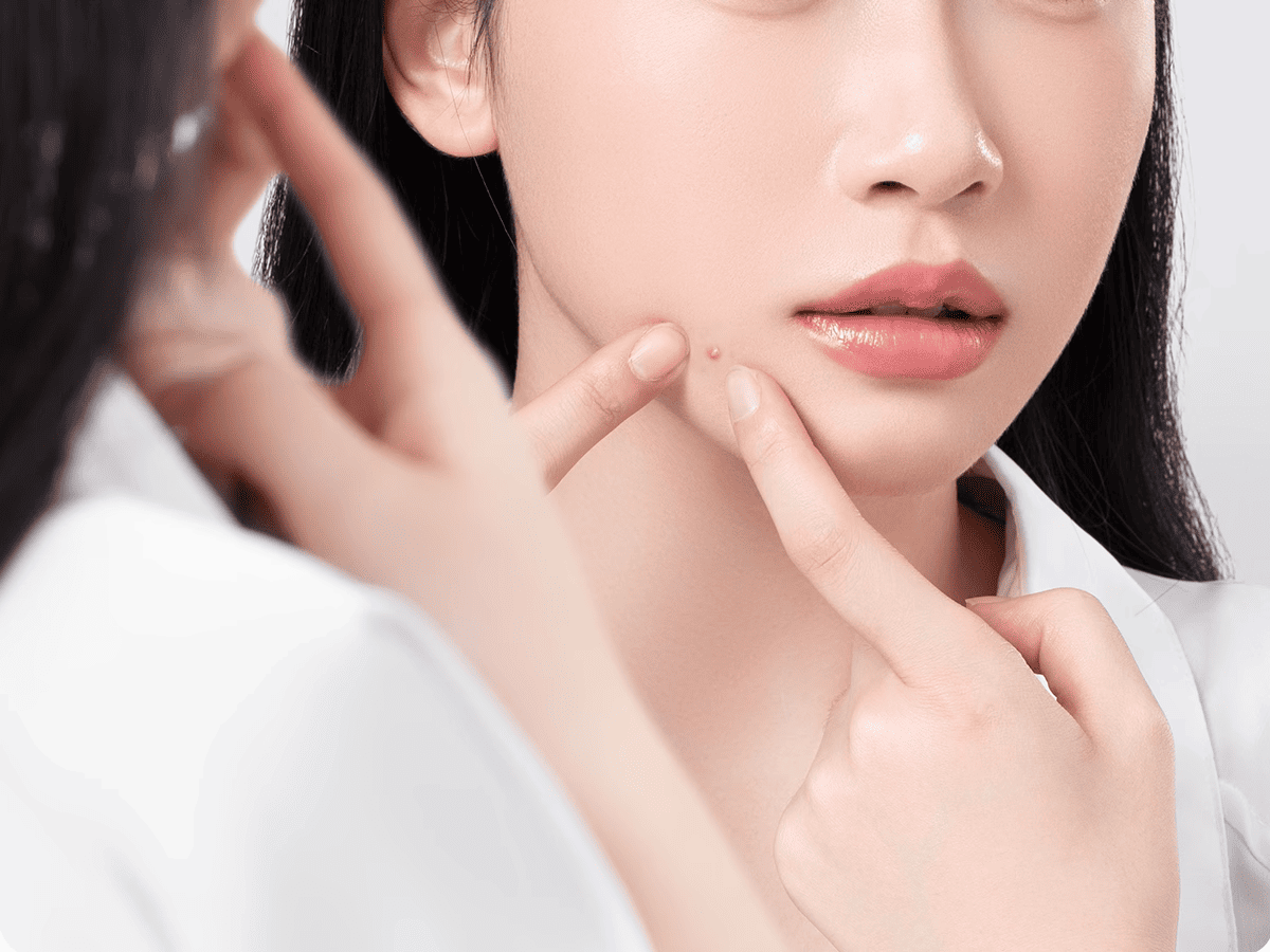 OEIEZ Non-Magnetic Ultra-Fine Comedone Extractor Pimple Tweezer Professional Blackhead Acne Beauty Clamp High-Precision Comedone Tweezer 5