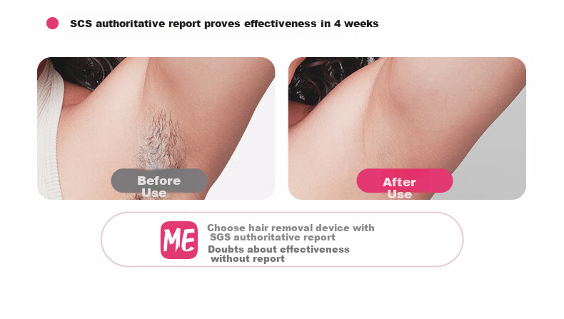 UlikeME [No Extra Charge for Wet Shaving] Sapphire Ice Point Hair Removal Device, Beard Trimmer, Full Body Razor, College Student Gift for Girlfriend Or Boyfriend, Birthday Present, Beauty Instrument 4