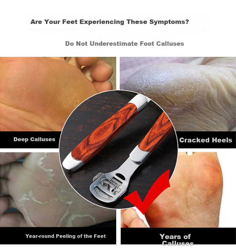Xingfutang Nano Glass Foot File, Pumice Stone, Pedicure Tool, Dead Skin Remover, Callus Remover for Heel And Foot 1