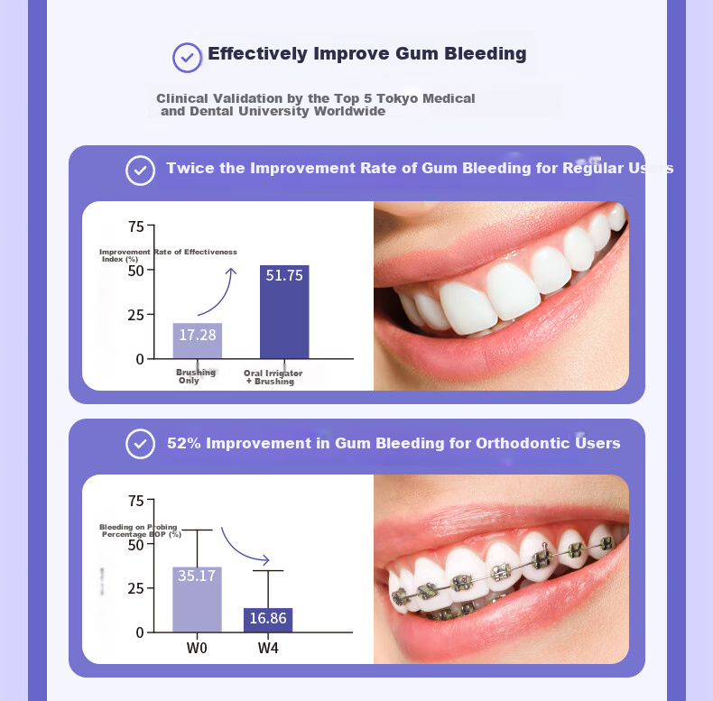 Bixdo Water Flosser Capsule Third Generation, Dental Irrigator, Retractable Portable Orthodontic Teeth Cleaner, Gift for Men And Women, Fathers, Mothers Day, High-End Birthday Present 6