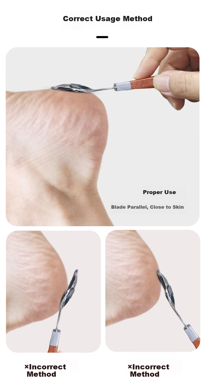 Xingfutang Nano Glass Foot File, Pumice Stone, Pedicure Tool, Dead Skin Remover, Callus Remover for Heel And Foot 9