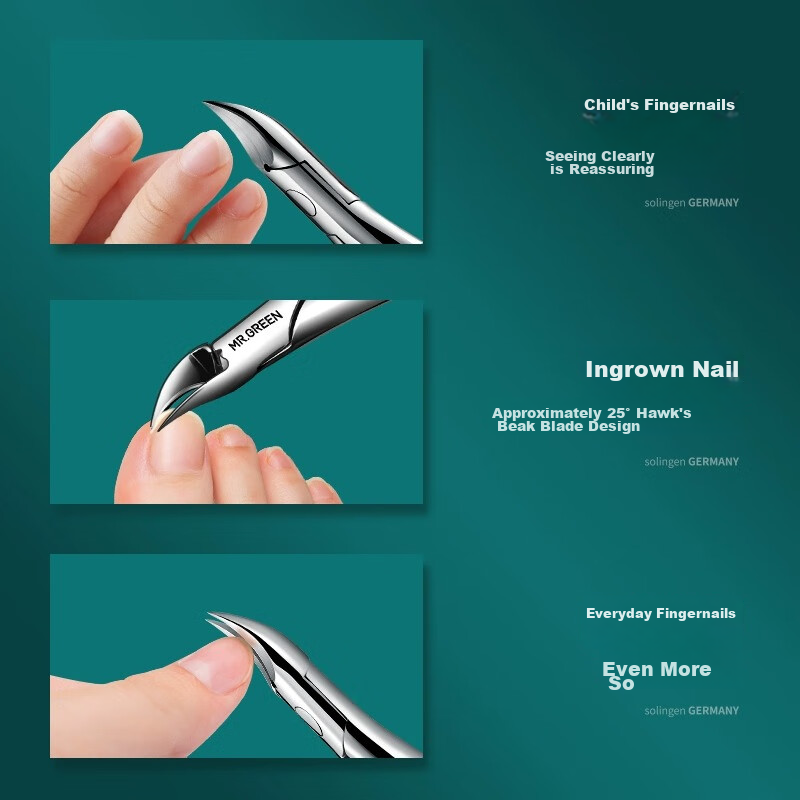 MR.GREEN German Ingrown Toenail Specialized Nail Clipper, Eagle Beak Pliers, Pedicure Knife, Ingrown Toenail Extractor, Mr-1036GRplus