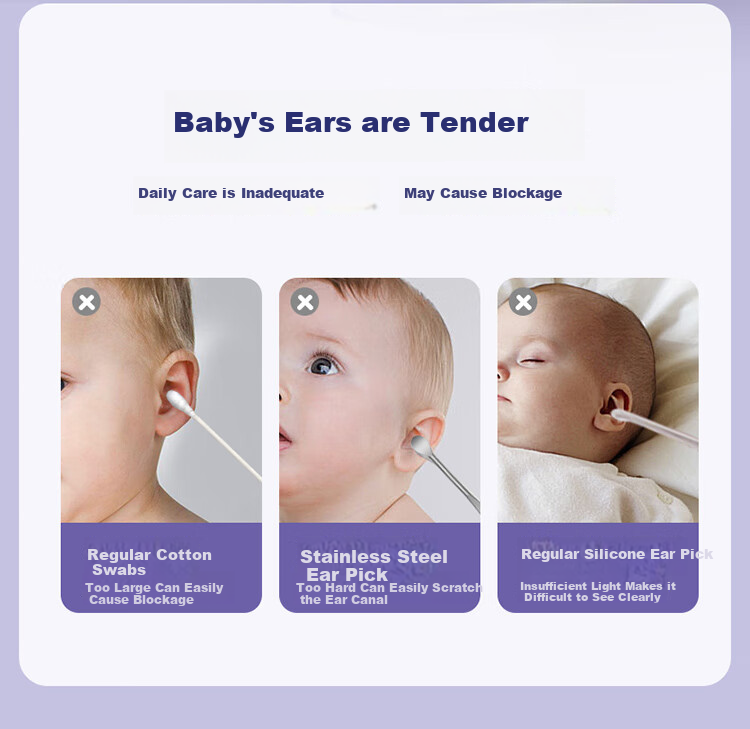 Shijian Children's Ear Pick, Illuminated Visual Ear Cleaning Tool Set, Rechargeable Version, 2-Piece Set, T86W 2