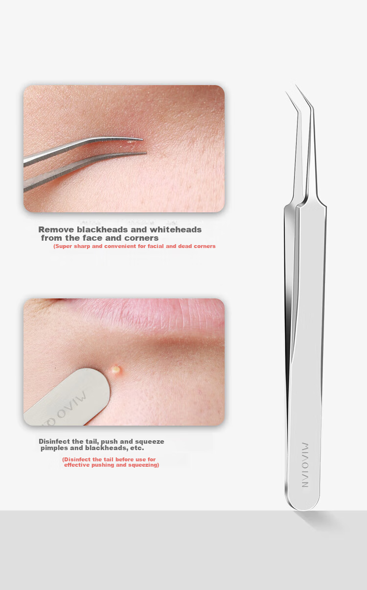 Miaoqian German Swiss No. 5 Cell Tweezers, Blackhead Extractor, Acne Removal Tool, Beauty Tweezers for Milia 6