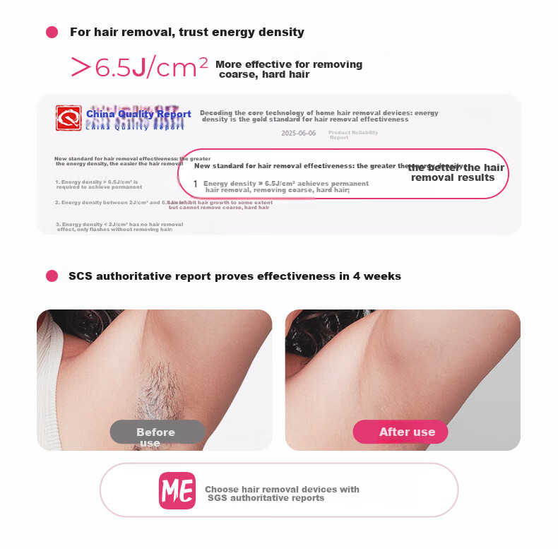 UlikeME [Recommended by Buying and Selling] Sapphire Ice Point Hair Removal Device, Beard Trimmer, Private Area Shaver, Full Body Hair Remover for College Students, Birthday Gift for Girlfriend Or Boyfriend, Brand Authorized 9